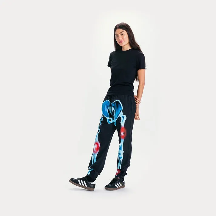 Market "Injuries" Track Pants